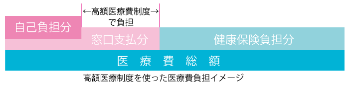 高額医療制度